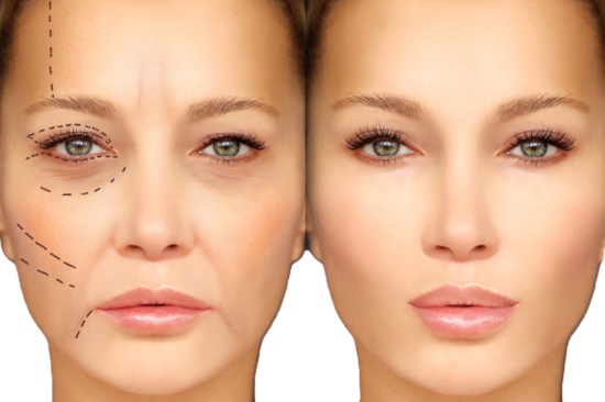 Look younger: Achieve your desired facial shape